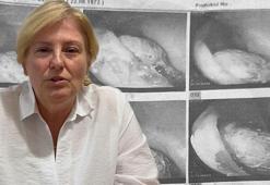 Gerçeği 4 yıl sonra öğrendi! Hayatının şokunu yaşadı: Bağırsağını delip, içine yerleşti