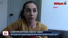 Lazer epilasyonda kabusu yaşadı