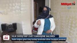 Kadın kılığına giren üvey kardeşi tarafından döner bıçağıyla yaralandı