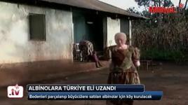 Türkiye Tanzanya’da albino köyü kuruyor