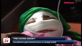 Kocası bu hale getirdi