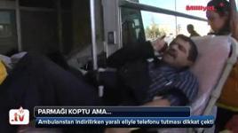 Parmağı koptu ama...