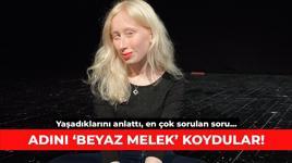 Adını 'beyaz melek' koydular! Yaşadıklarını anlattı, en çok sorulan soru...