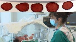 Komplo teorileri nedeniyle aileler topuk kanı taramasını reddediyor