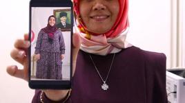Ameliyat oldu, hayatı değişti! 'İnsanlar beni sesimden tanıyor'