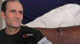 Aldığı etten 'şarbon' bulaştıktan sonra ölümden döndü, evine et sokmuyor 