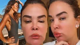 'Önce minibüs çarptı, sonra uçağıma yıldırım düştü! Bu sabah da böyle uyandım'