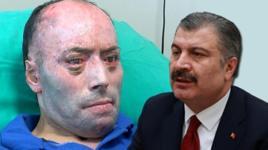 8 ayda 140 ameliyat geçirdi, taburcu oldu! Bakan Koca açıklama yaptı