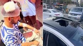 İstanbul'da şoke eden olay! Alev alan tüp balkondan atıldı, sürücünün kafasını yardı