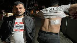  Mesaisi bittiği için yolcu almayan taksici, makaslı saldırıda yaralandı