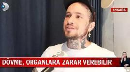 Dövme yaptıranlar dikkat! Organlara bile zarar verebilir