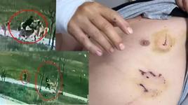 Oğlu için kendini feda etti, köpek sürüsünün arasında kaldı!