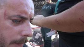 'Enginar' dayağı! İstanbul'da akılalmaz anlar: Kaçırmak istediler, tehdit ettiler