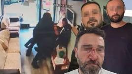 Emlakçıya tadilat dayağı! Burnunu kırıp serbest kaldı