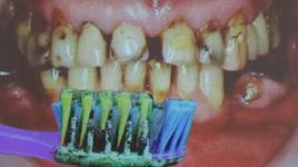 6 kişilik ailenin tamamı aynı diş fırçasını kullandı