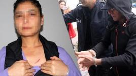 Cani komşudan ölüm düzeneği! Kapının önünden geçmesini bekledi: Kalbimi hedef aldı