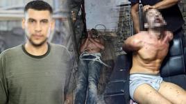Patronları tarafından günlerce işkence gören Vedat: Yıllardır bu olayla uğraşıyorum
