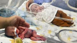 Mucize görüntü: 380 gram doğan Hira Su bebeğin yaşama sarılışı
