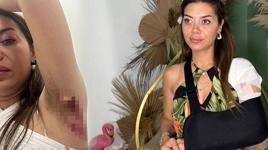 Sokakta yürürken jilet gibi kesikle yaralandı! ‘Kolumu kaybedebilirdim’