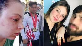 Kendisini darbeden milli sporcu eşinden şikayetçi oldu