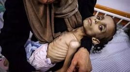 İsrail’in kıtlığa sürüklediği Gazze’de 9 yaşındaki Meryem, 25 kilodan 10 kiloya düştü