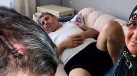 Miras anlaşmazlığı yaşadığı yeğenini, beyzbol sopasıyla dövdü