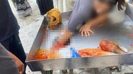 Şanlıurfa'da korkunç kaza! 16 yaşındaki genç kızın eli salça makinesine sıkıştı