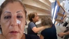 Ankara’da komşu kabusu! Kedileri beslediği için burnunu kırdılar: 'Bugün seni öldüreceğiz’