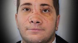 Yedikleri burnundan gelecekti! 19 yaşındaki Ömer'in ihmali: Arkadaşlarım da aynı hatayı yapmasın