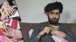 Hatay’da şoke eden hikaye! 3 yıldır evden çıkmıyor, banyo yapmıyor, sadece telefon ve bilgisayarla yaşıyor