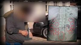 Aksaray'da akılalmaz olay! Midesinden 433 gram metamfetamin çıktı