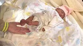 Elsiz ve ayaksız doğma ihtimali vardı! Anne karnında operasyon