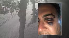 Kedi beslemek isteyen iş insanına 'Yolu kapattın' dayağı