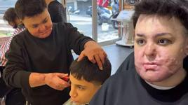 Hayatı birkaç saniye içinde kabusa döndü!15 yaşında 8 ayda 65 ameliyat geçirdi