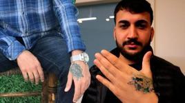 Dövme sildirmek isterken felaketi yaşadı! 'Eczaneden ağrı kesici al'