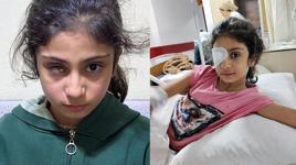 8 yaşındaki Şeyma’yı kör eden gözlük! Aile şaşkına döndü: ‘Kızımın geleceği gitti’