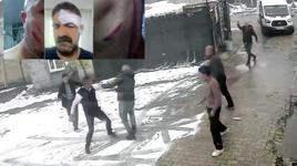 Evinin önüne tuvaletini yapanı uyardı, dayak yedi: Burası dağ başı mı?