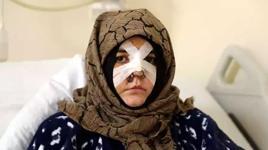 Eşinin kaldırım taşı ile dövdüğü Nazlı: Ayaklarım üzerinde dursaydım o adama dönmezdim