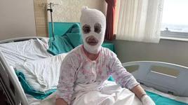 İftar vakti düdüklü tencere faciası! ‘Yüzüme elimi sürdüm, et parçası geliyordu'