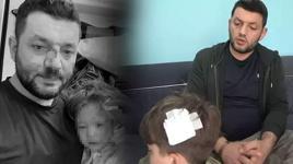 Kucağında bebeği ile darbedilen babanın oğlu, sokakta başına atılan taşla yaralandı