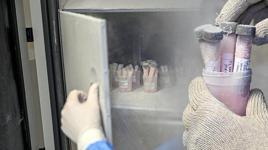 Ölenlerin sırt ve bacaklarından alınıyor! Türkiye'de bu merkezde saklanıyor... Detaylar ortaya çıktı