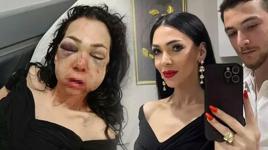 Kocaeli'de dehşeti yaşayan kadın konuştu: Asla eskisi gibi olamayacağım