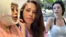 Yüz nakli olan Didem Ceran son halini paylaştı! ‘Bebeksiliğim yapay zeka değil’