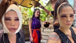 Yüz nakli hayatını kabusa çevirmişti! Survivor Didem Ceran'dan arınma ritüeli