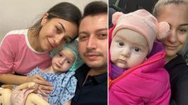 Doğum lekesi sandı, hastalık belirtisi çıktı! ‘Bebeğimdeki değişimler Proteus sendromunun işaretiymiş’