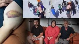 İki ailenin meydan savaşı: Mangal yapıp bize gıcıklık veriyorlar