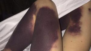 Su çiçeği bu hale getirdi