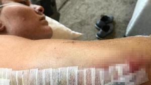 Lindsey Vonn hasta yatağından paylaştı Kırık kolu...