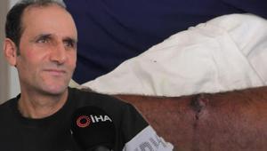 Yediği etten şarbon bulaştı, ölümden döndü