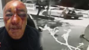 Taksici dehşeti yaşadı Dikiz aynasını kırıp önce öldüresiye dövdü sonra gasp etti